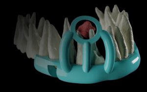 Deep learning en Blender for Dental